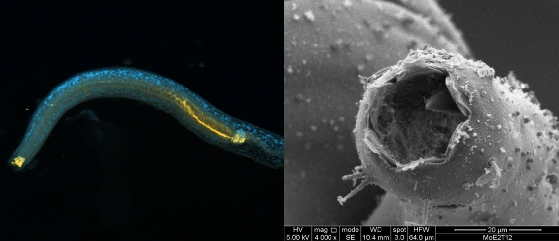 Nématodes hydrothermaux montrant une communauté microbienne bien développée, tant à l’intérieur qu’à l’extérieur de la bouche